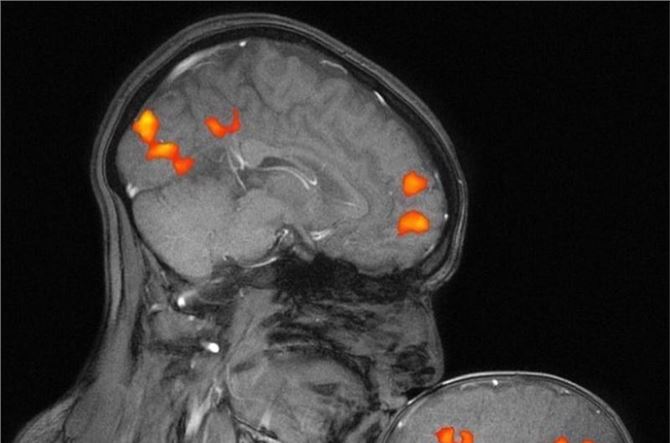 This is the first MRI capturing the brain activity of a mother kissing her child...
