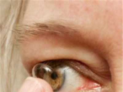 Contact lens which releases drugs into the eye gives new hope to glaucoma sufferers