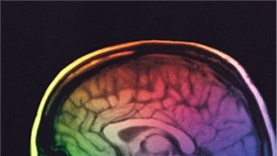 Girls who are autistic have more  “masculine”  brains. 