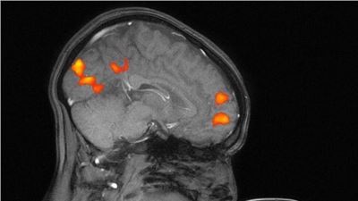 This is the first MRI capturing the brain activity of a mother kissing her child...