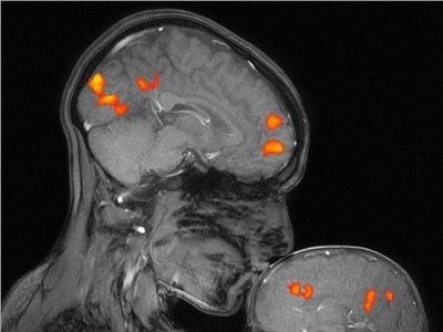 This is the first MRI capturing the brain activity of a mother kissing her child...