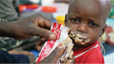 Una pasta di noccioline potente “farmaco” salvavita di bambini.